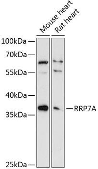 Cell Biology Antibodies 12 Anti-RRP7A Antibody CAB9617