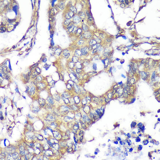 Cell Biology Antibodies 12 Anti-TXNDC9 Antibody CAB9676