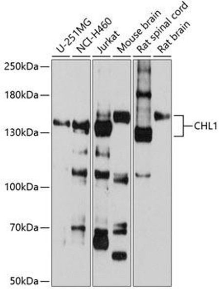 Cell Biology Antibodies 12 Anti-CHL1 Antibody CAB9681