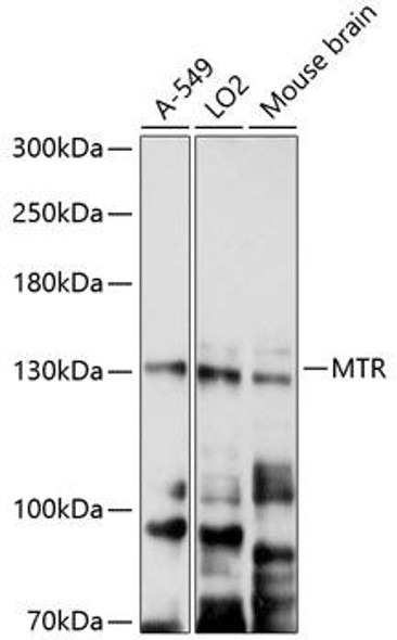 Metabolism Antibodies 3 Anti-MTR Antibody CAB9731