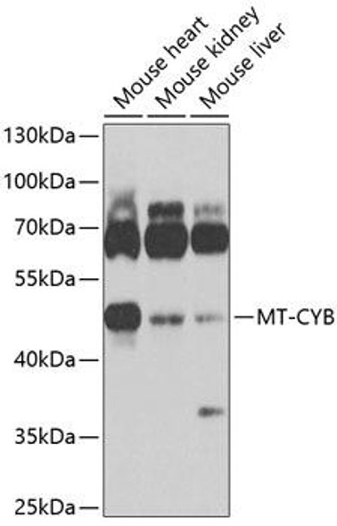 Cell Biology Antibodies 12 Anti-MT-CYB Antibody CAB9762