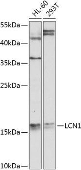 Signal Transduction Antibodies 3 Anti-Lipocalin-1 Antibody CAB9828