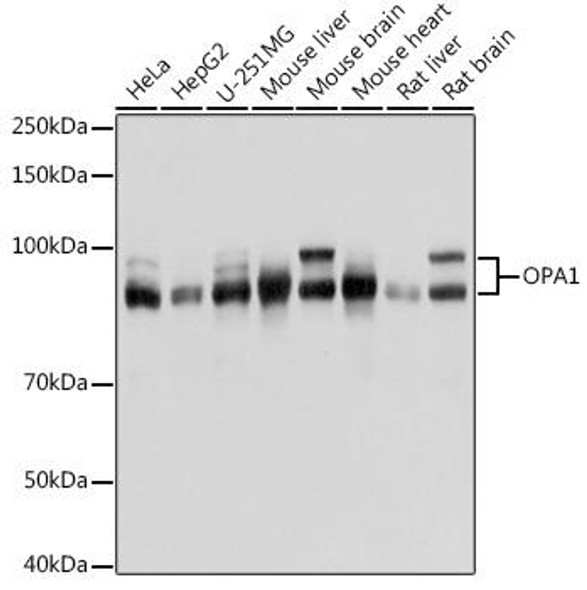 Cell Death Antibodies 2 Anti-OPA1 Antibody CAB9833