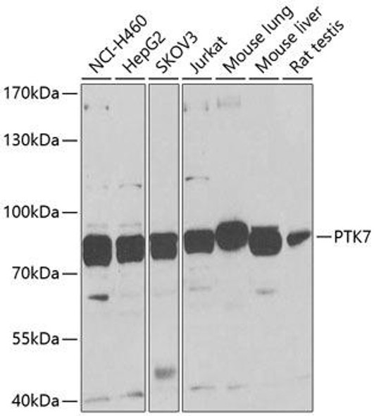 Cell Biology Antibodies 12 Anti-PTK7 Antibody CAB9839