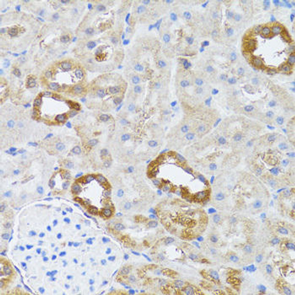 Immunology Antibodies 3 Anti-RNASEL Antibody CAB9840