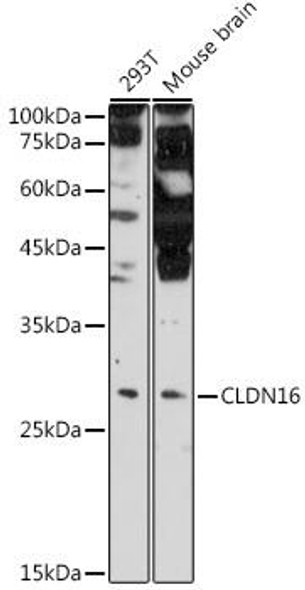 Signal Transduction Antibodies 3 Anti-Claudin-16 Antibody CAB9862