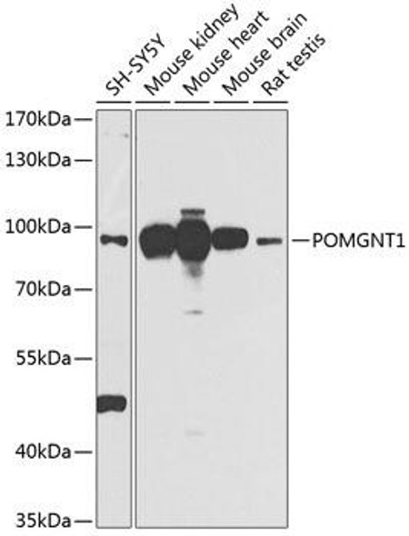 Cell Biology Antibodies 12 Anti-POMGNT1 Antibody CAB9879