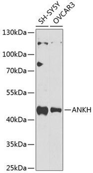 Signal Transduction Antibodies 3 Anti-ANKH Antibody CAB9881