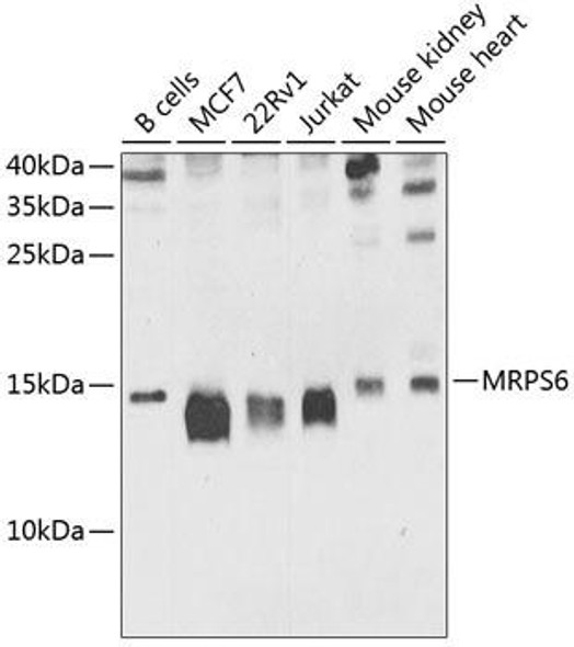 Cell Biology Antibodies 12 Anti-MRPS6 Antibody CAB9884