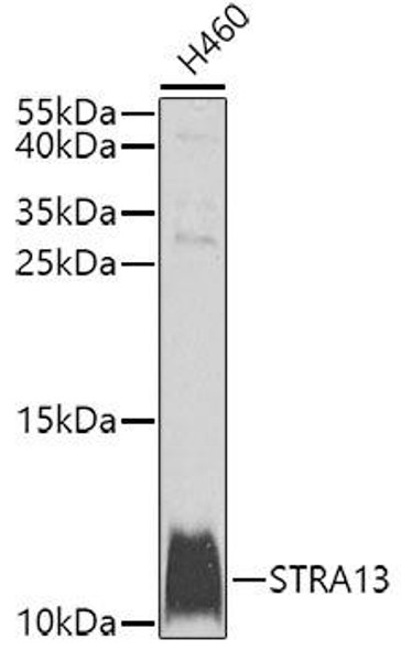 Cell Cycle Antibodies 2 Anti-STRA13 Antibody CAB9892