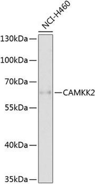 Cell Biology Antibodies 12 Anti-CAMKK2 Antibody CAB9899