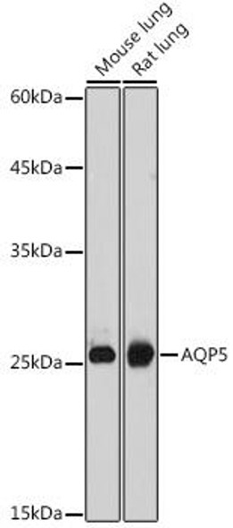 Signal Transduction Antibodies 3 Anti-Aquaporin-5 Antibody CAB9927