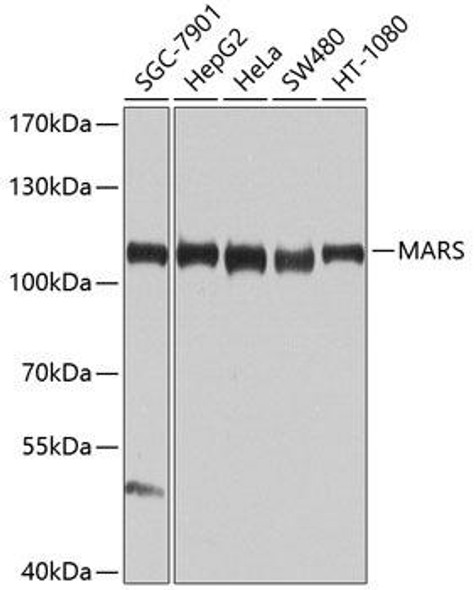 Metabolism Antibodies 3 Anti-MARS Antibody CAB9938