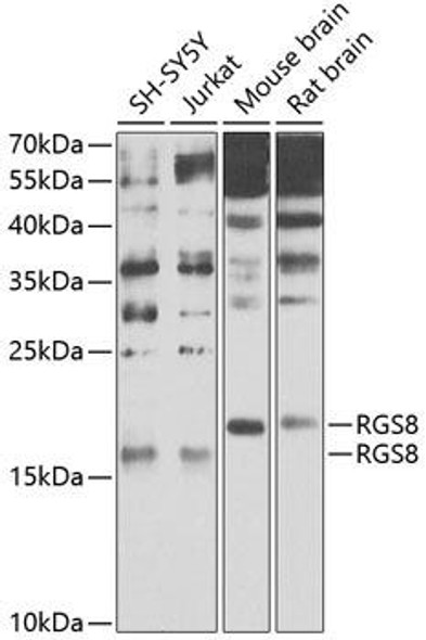 Cell Biology Antibodies 16 Anti-RGS8 Antibody CAB9987