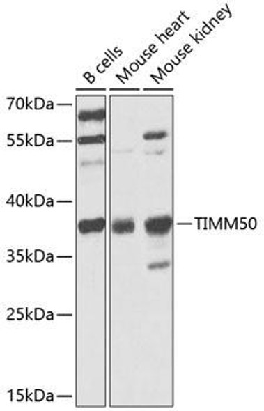 Cell Biology Antibodies 16 Anti-TIMM50 Antibody CAB9991