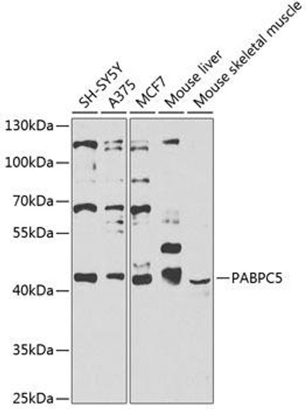 Cell Biology Antibodies 16 Anti-PABPC5 Antibody CAB9997