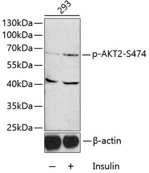Cell Death Antibodies 2 Anti-Phospho-AKT2-S474 Antibody CABP0005