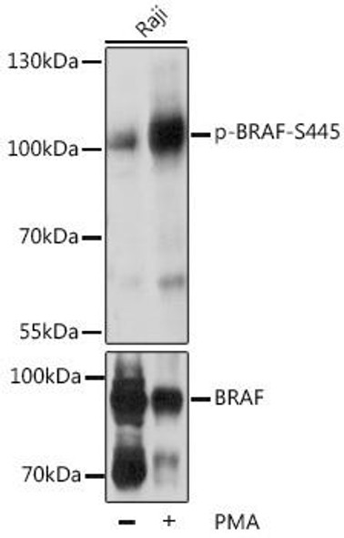 Cell Biology Antibodies 16 Anti-Phospho-BRAF-S445 Antibody CABP0012