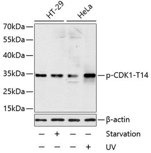 Cell Death Antibodies 2 Anti-Phospho-CDK1-T14 Antibody CABP0015