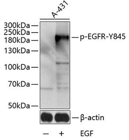 Immunology Antibodies 3 Anti-Phospho-EGFR-Y845 Antibody CABP0023