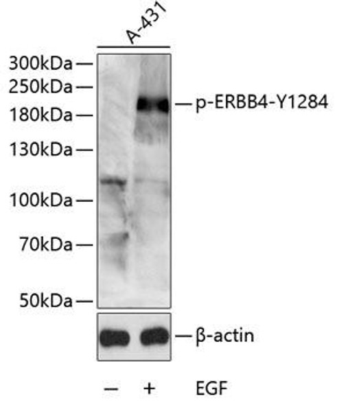 Cell Death Antibodies 2 Anti-Phospho-ERBB4-Y1284 Antibody CABP0034