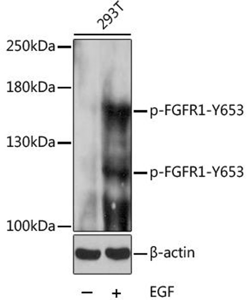 Epigenetics and Nuclear Signaling Antibodies 4 Anti-Phospho-FGFR1-Y653 Antibody CABP0036