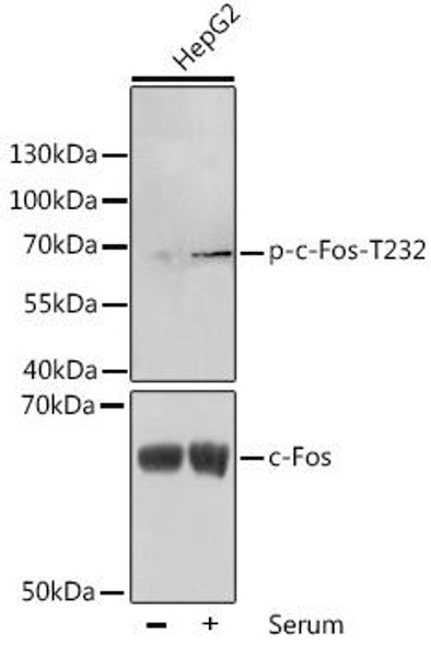 Cell Biology Antibodies 16 Anti-Phospho-FOS-T232 Antibody CABP0038