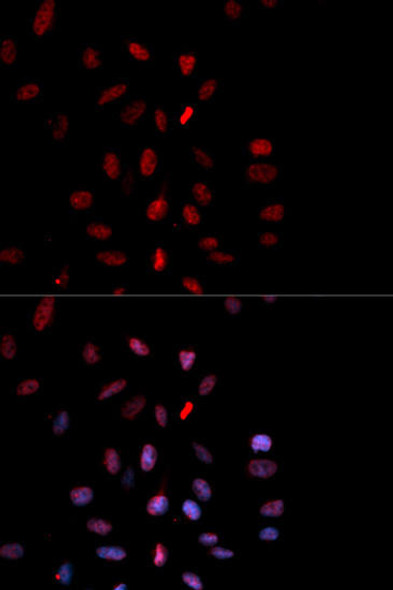 Cell Biology Antibodies 16 Anti-Phospho-FOS-T232 Antibody CABP0038