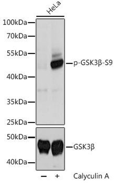 Cell Biology Antibodies 16 Anti-Phospho-GSK3B-S9 Antibody CABP0039