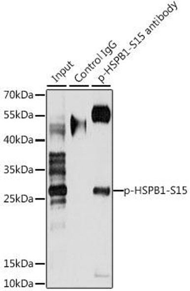 Immunology Antibodies 3 Anti-Phospho-HSPB1-S15 Antibody CABP0040