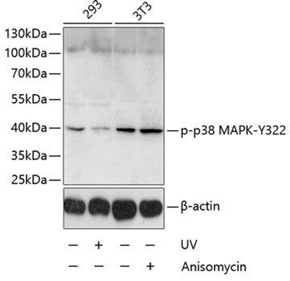 Cell Death Antibodies 2 Anti-Phospho-MAPK14-Y322 Antibody CABP0055