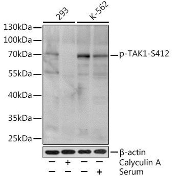Cell Death Antibodies 2 Anti-Phospho-MAP3K7-S412 Antibody CABP0071