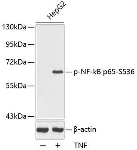Immunology Antibodies 3 Anti-Phospho-RELA-S536 Antibody CABP0124