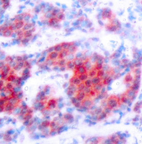 Epigenetics and Nuclear Signaling Antibodies 4 Anti-Phospho-STAT4-Y693 Antibody CABP0137