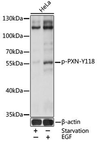 Cell Biology Antibodies 16 Anti-Phospho-Paxillin-Y118 Antibody CABP0156