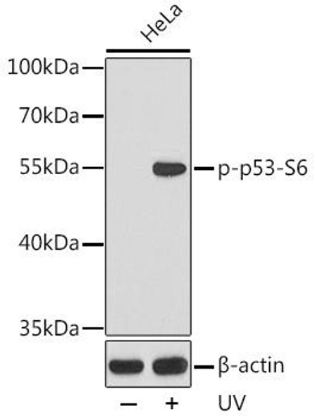 Cell Death Antibodies 2 Anti-Phospho-TP53-S6 Antibody CABP0157