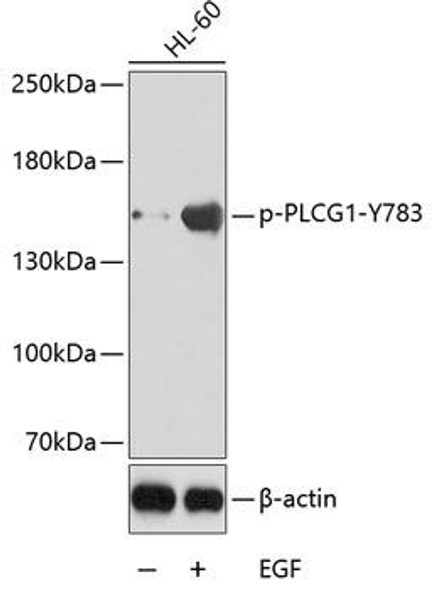 Immunology Antibodies 3 Anti-Phospho-PLCG1-Y783 Antibody CABP0164