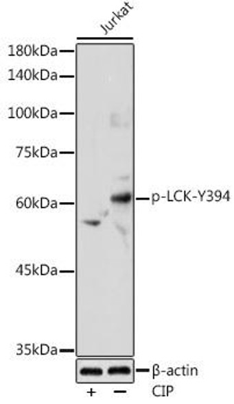 Immunology Antibodies 3 Anti-Phospho-LCK-Y394 Antibody CABP0182