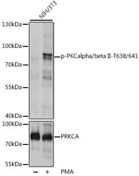 Cell Biology Antibodies 16 Anti-Phospho-PKCalpha/beta II-T638/641 Antibody CABP0191