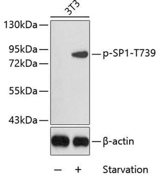 Cell Biology Antibodies 16 Anti-Phospho-SP1-T739 Antibody CABP0231