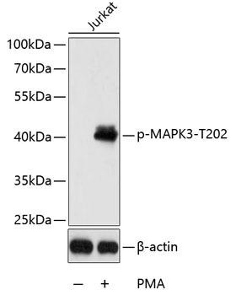 Cell Death Antibodies 2 Anti-Phospho-MAPK3-T202 Antibody CABP0234