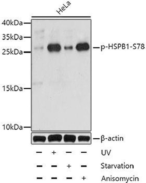 Immunology Antibodies 3 Anti-Phospho-HSPB1-S78 Antibody CABP0236