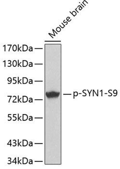 Cell Biology Antibodies 16 Anti-Phospho-Synapsin-1-S9 Antibody CABP0244