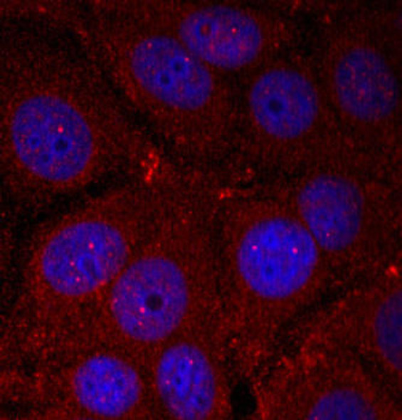 Cell Biology Antibodies 16 Anti-Phospho-Alpha-synuclein-Y136 Antibody CABP0254