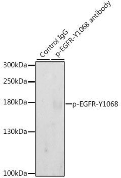 Immunology Antibodies 3 Anti-Phospho-EGFR-Y1068 Antibody CABP0301