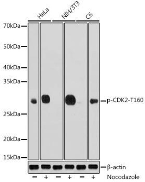 Cell Cycle Antibodies 2 Anti-Phospho-CDK2-T160 Antibody CABP0325