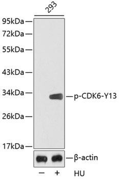 Cell Cycle Antibodies 2 Anti-Phospho-CDK6-Y13 Antibody CABP0326