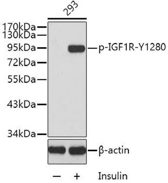 Cell Biology Antibodies 16 Anti-Phospho-IGF1R-Y1280 Antibody CABP0368