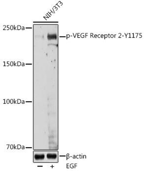 Cardiovascular Antibodies Anti-Phospho-KDR-Y1175 Antibody CABP0382
