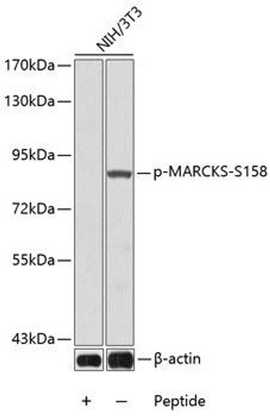 Cell Biology Antibodies 16 Anti-Phospho-MARCKS-S158 Antibody CABP0402
